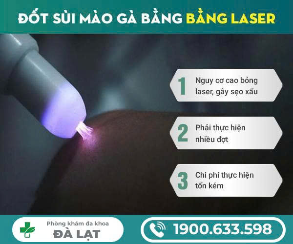 Hình ảnh minh họa